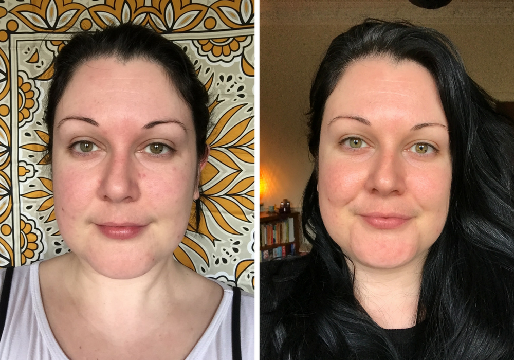 Merumaya Before & After