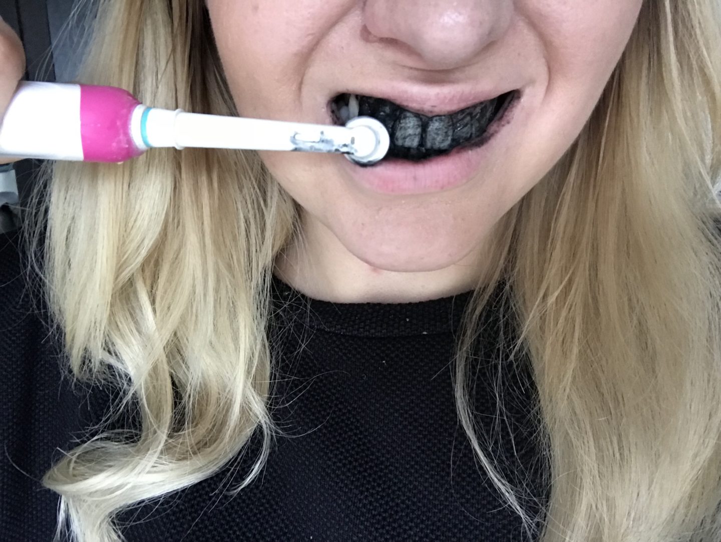 Teeth Whitening, She Might Be